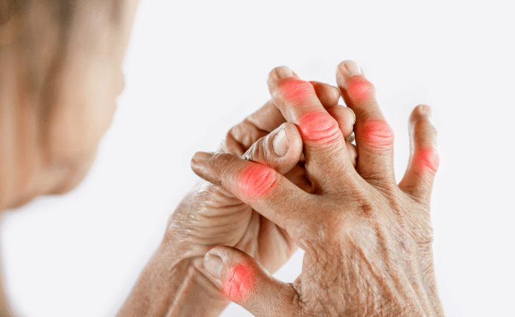 CBD Oil for Arthritis & Joint Pain